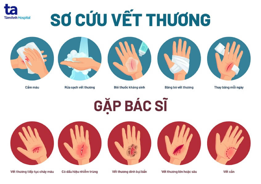 Cách sơ cứu vết thương đúng kỹ thuật với từng loại thương tổn